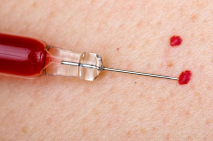 The Little Red Spots on Your Skin Might Indicate These Condi