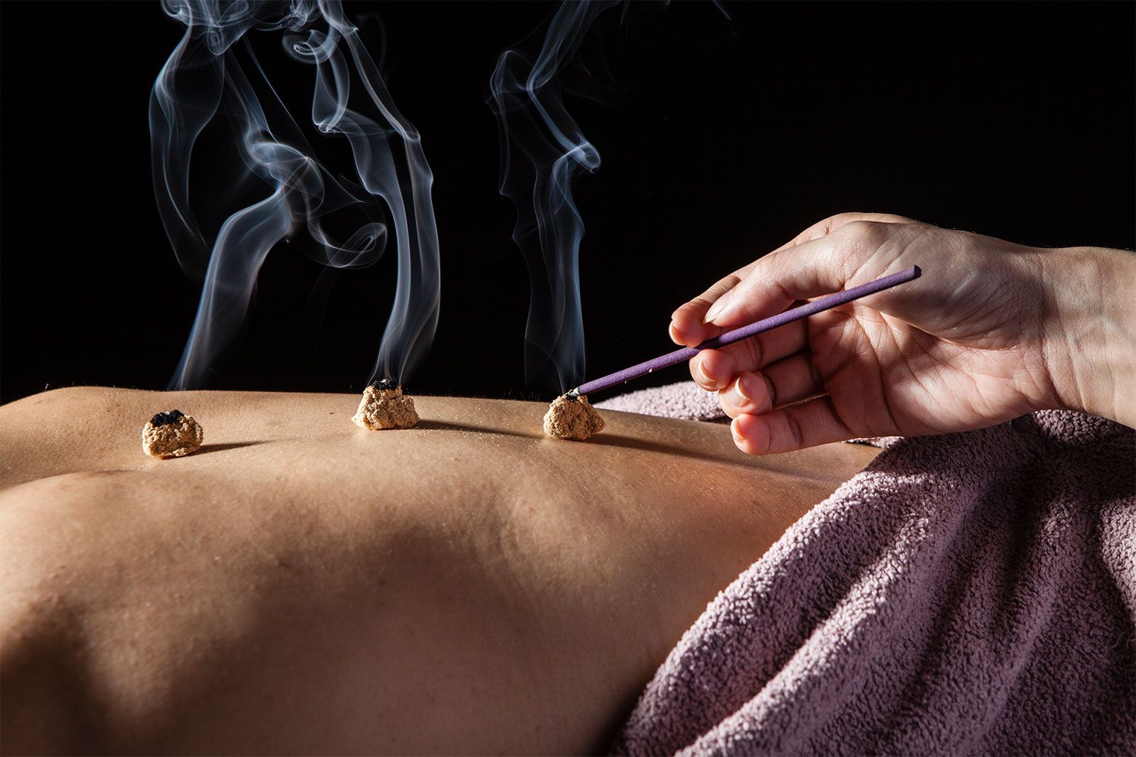 Moxibustion's Timeless Wisdom for Modern Wellness
