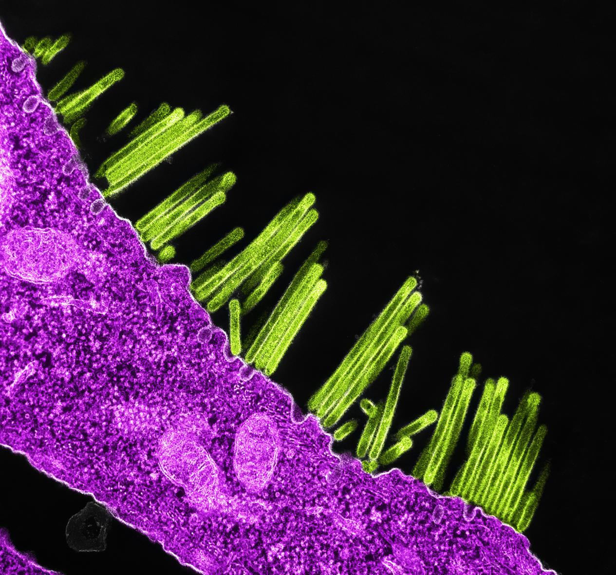 national-institute-of-allergy-and-infectious-diseases-mL0PCnNOykw-unsplash